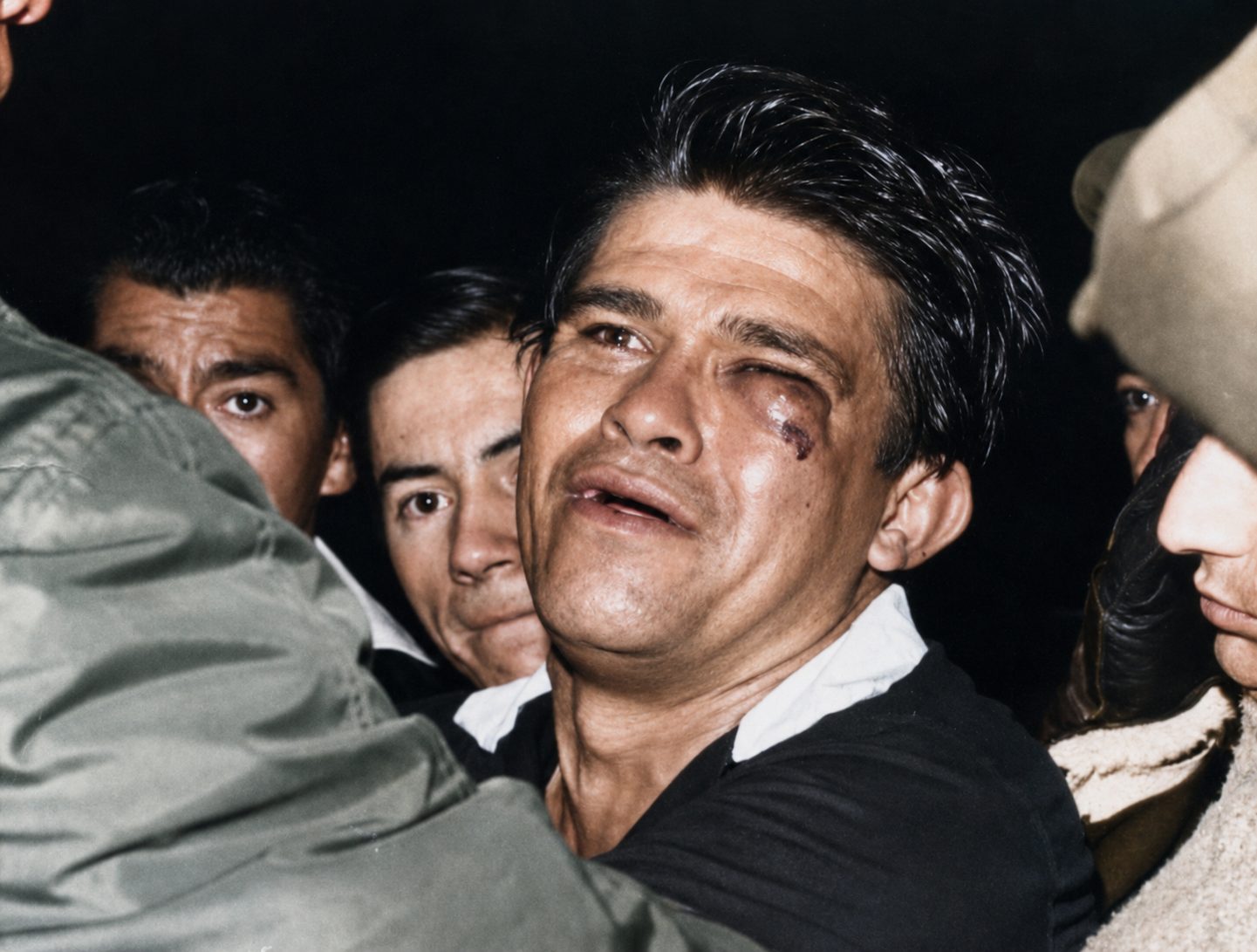 El Chato con el rostro golpeado tras la agresión, El Campín 1968